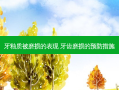 牙釉质被磨损的表现 牙齿磨损的预防措施
