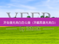 牙齿激光美白怎么做（牙龈黑激光美白）